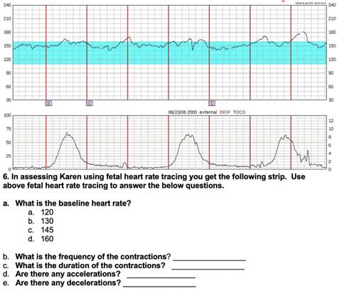 Relias fetal heart monitoring answers. Things To Know About Relias fetal heart monitoring answers. 